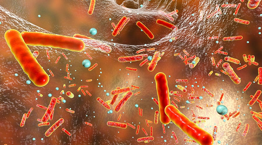 Infectious Diseases A to Z – Acinetobacter Bacteria Infections