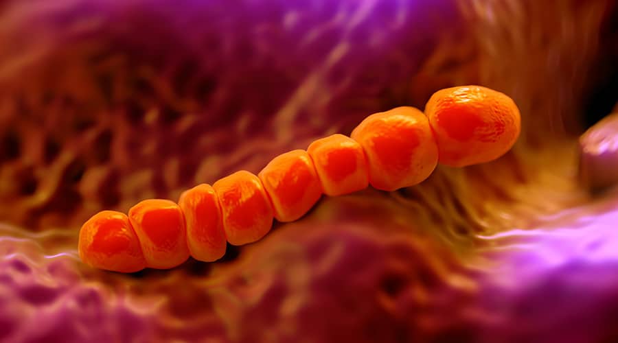 What Nurses Should Know About Different Types of Pneumonia
