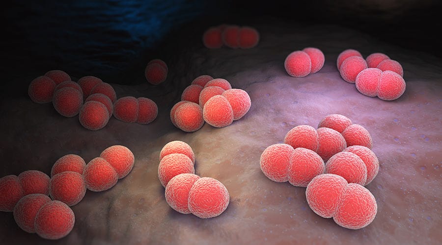 Infectious Diseases A to Z: Bacterial Meningitis
