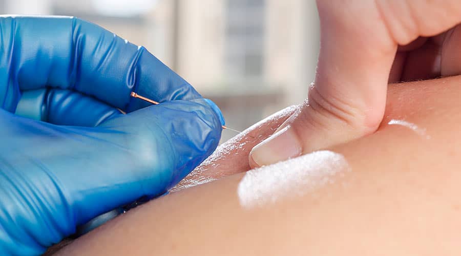 North Carolina PTs Victorious in Battle Over Dry Needling