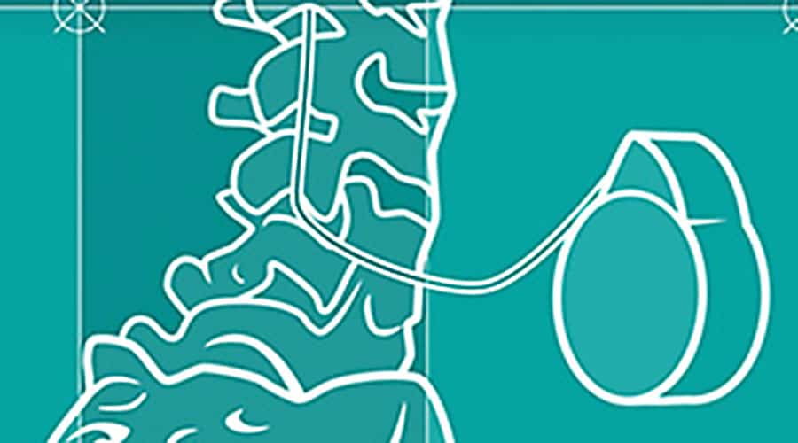 Managing Cancer Pain