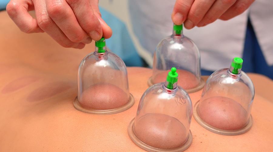 Comprehensive Manual Therapy: Functional Cupping with IASTM and Joint Mobilizations
