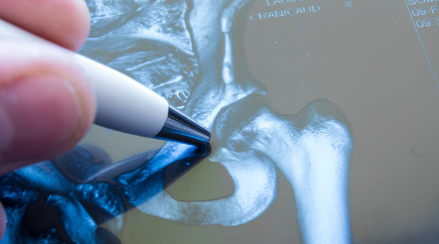 Assessments & Clinical Strategies for Total Joint Replacement of the Hip & Knee – Live Course