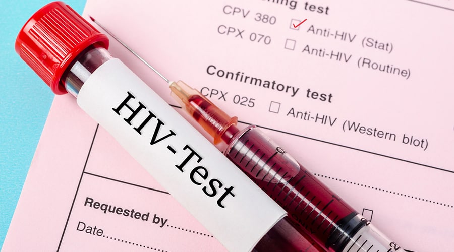 Survey: Social Norms Play Significant Role in HIV Screening