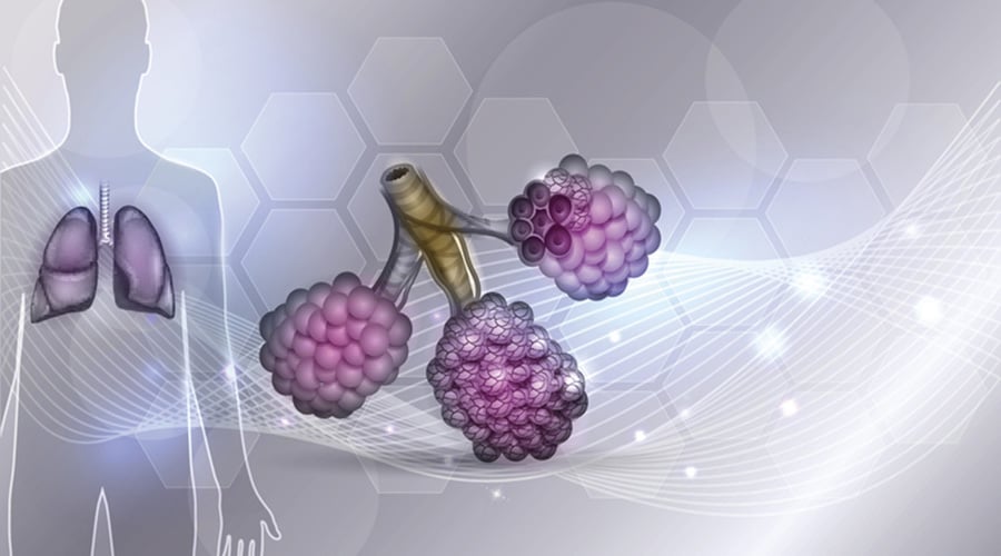 Can Amphotericin Aid in Treatment of Cystic Fibrosis?