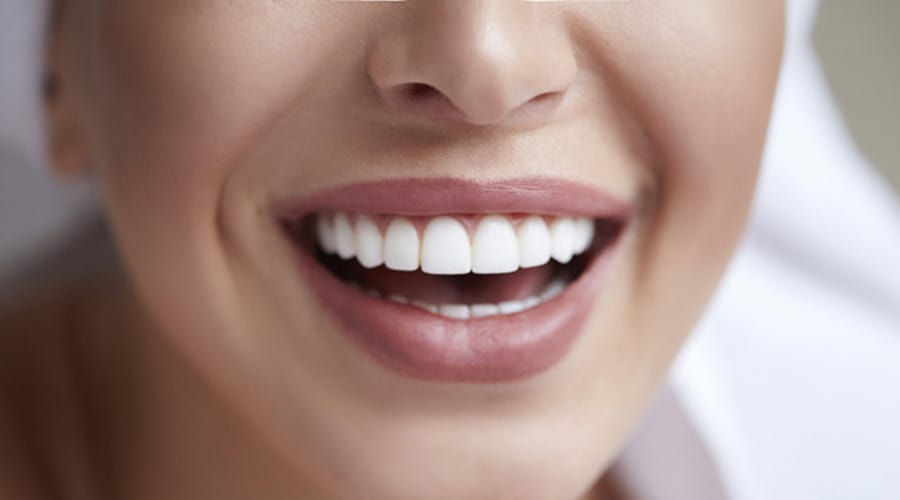 Research shows evidence of oral pathogen DNA in stroke patients