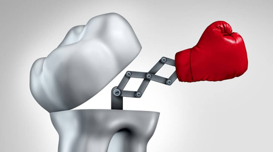 New Bioactive Peptide the Latest in Cavity Treatment