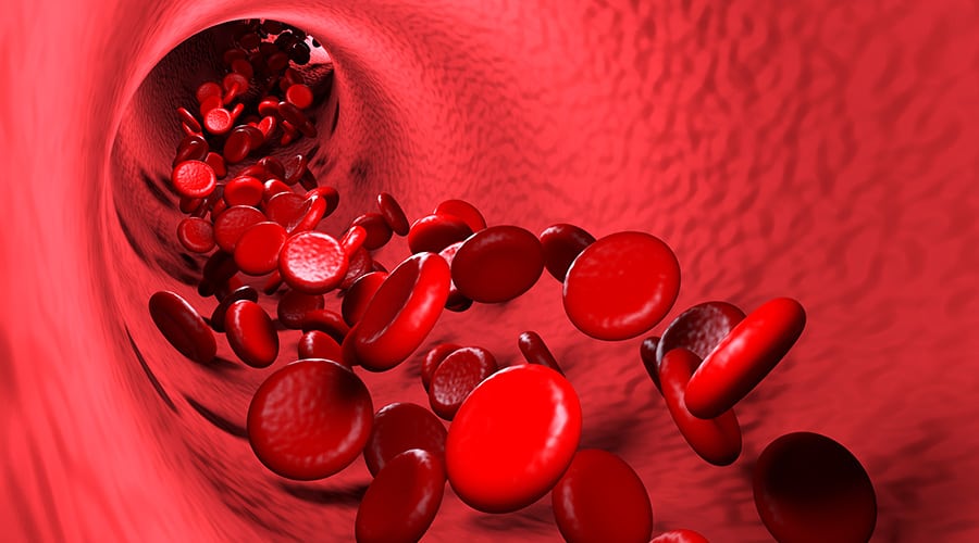 Blood-flow Restriction Training: Does it Work?