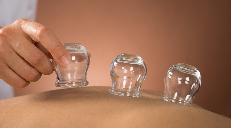Manual Therapy: Functional Cupping Applications