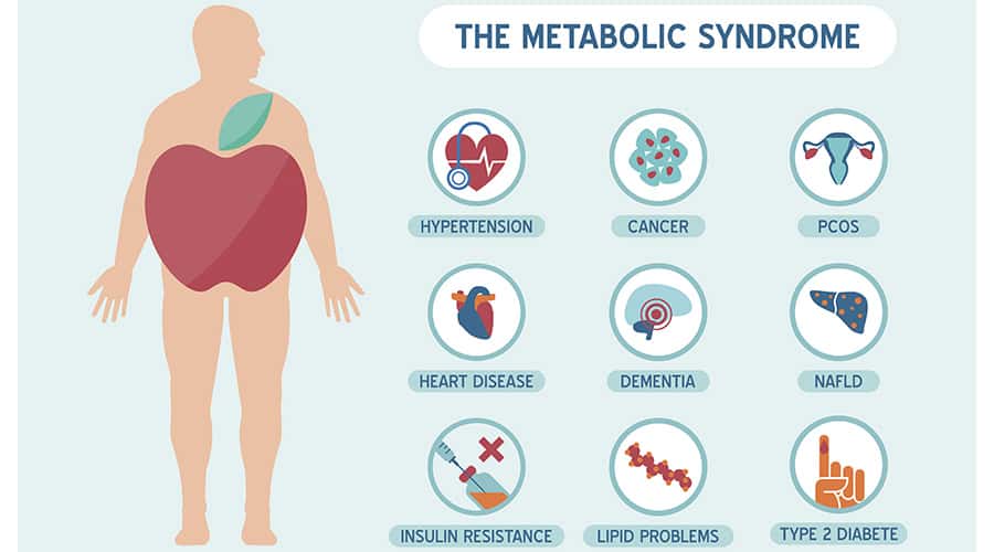 Metabolic Syndrome: Risks and Innovative Solutions