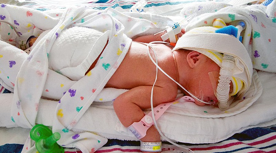 Neonatal Abstinence Syndrome: Long-term Effects