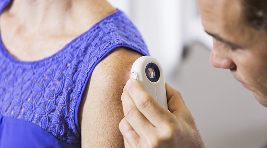 Playing Your Part to Prevent Skin Cancer