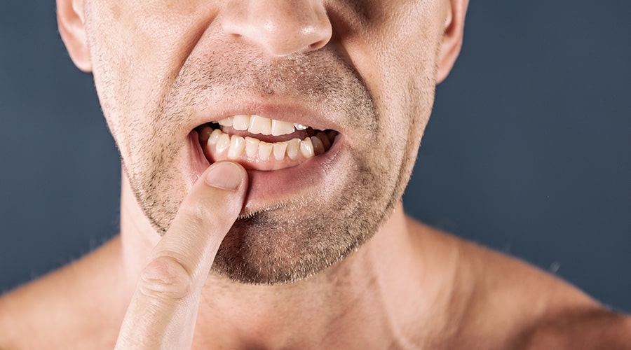 Gum Disease May Increase Risk of Cancer