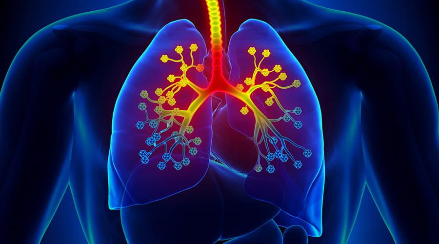 Early Childhood Bronchitis Linked to Later Lung Disease