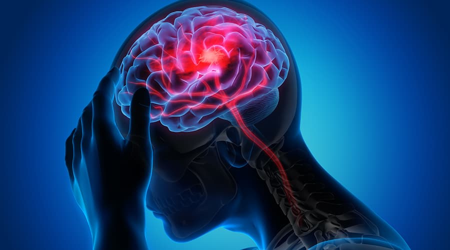 Scientists to Connect Stroke Survivors