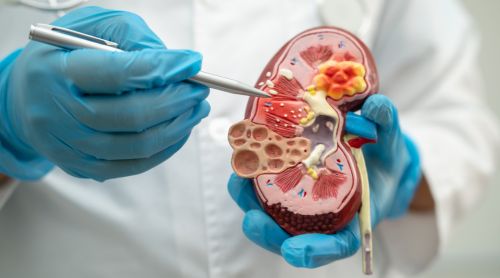 Proteinuria and Hematuria